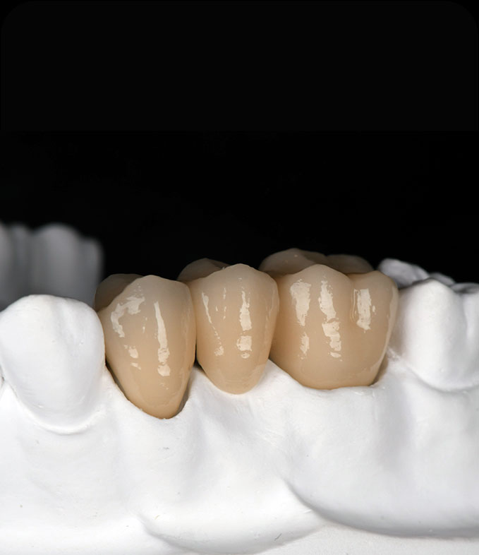 peak-zirconia-4
