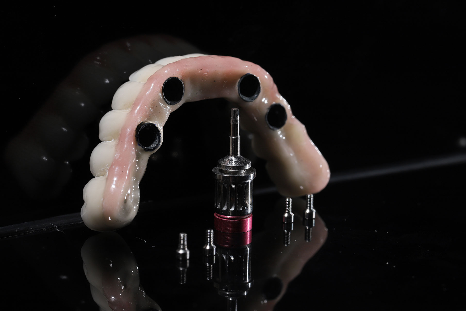 all-on-x restoration