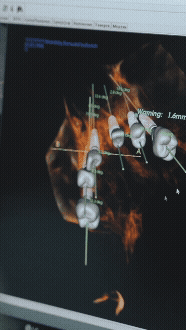 all-on-x lab workflow