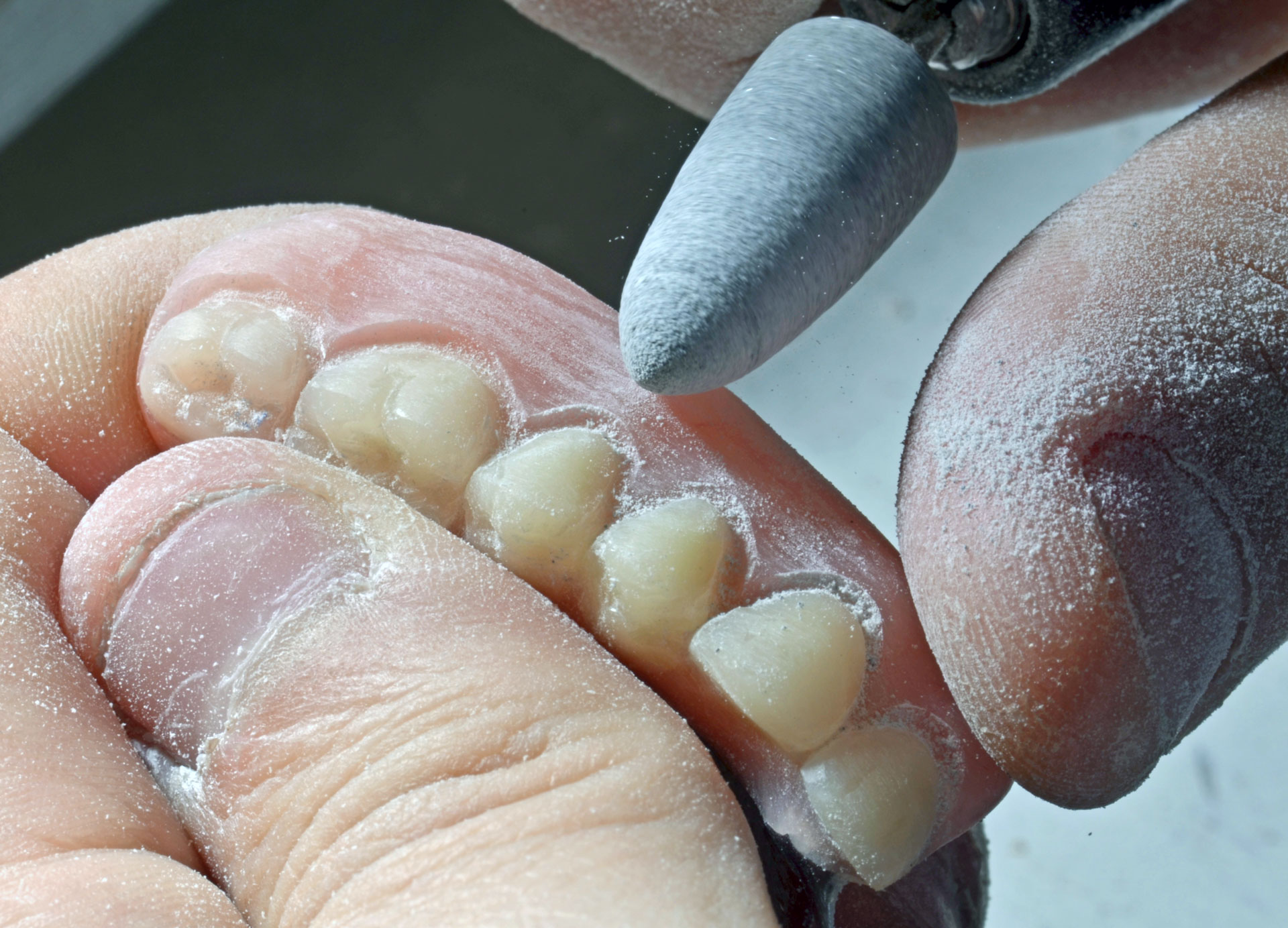 Removable partial denture being hand-finished at the bench