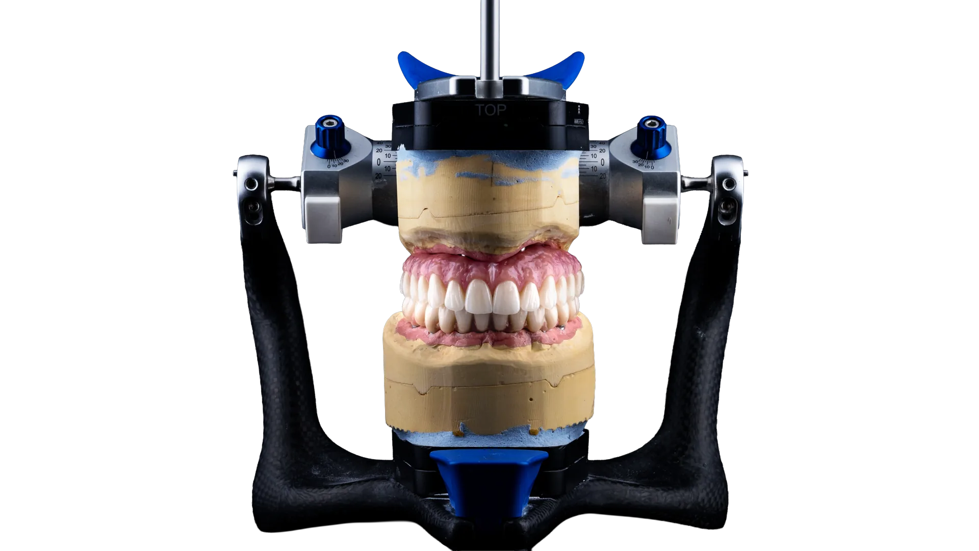 Peak Signature All-on-X upper and lower prostheses mounted on an articulator